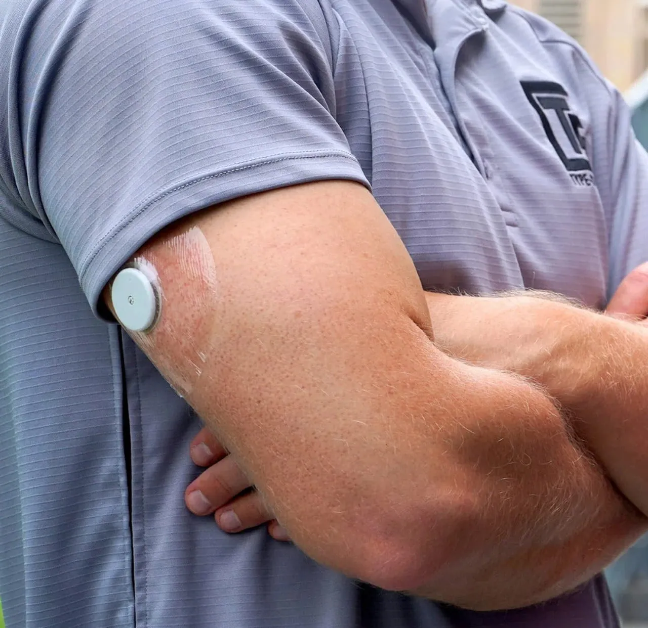 A continuous glucose monitor sensor worn on the back of an arm